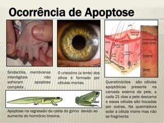Ocorrência de Apoptose 
Sindactilia, membranas interdigitais não sofreram apoptose completa . 
Queratinócitos são células apoptóticas presente na camada externa da pele, a cada 21 dias a pele descama e essas células são trocadas por outras. Na queimadura solar a célula morre mas não se fragmenta 
Apoptose na regressão da calda do girino devido ao aumento do hormônio tiroxina. 
O cristalino (a lente) dos olhos é formado por células mortas.  