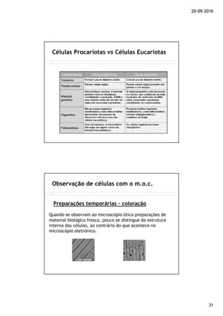 20-09-2016
31
Células Procariotas vs Células Eucariotas
Observação de células com o m.o.c.
Preparações temporárias - coloração
Quando se observam ao microscópio ótico preparações de
material biológico fresco, pouco se distingue da estrutura
interna das células, ao contrário do que acontece no
microscópio eletrónico.
 