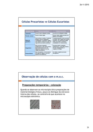 26-11-2015
31
Células Procariotas vs Células Eucariotas
Observação de células com o m.o.c.
Preparações temporárias - coloração
Quando se observam ao microscópio ótico preparações de
material biológico fresco, pouco se distingue da estrutura
interna das células, ao contrário do que acontece no
microscópio eletrónico.
 