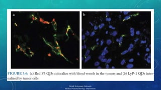 14 
Mehdi Soleymani Goloujeh 
Medical Nanotechnology Department 
 