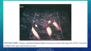 18 
Mehdi Soleymani Goloujeh 
Medical Nanotechnology Department 
 