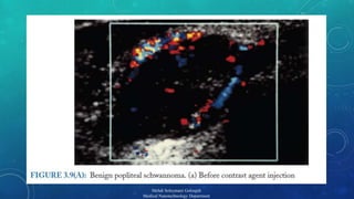 19 
Mehdi Soleymani Goloujeh 
Medical Nanotechnology Department 
 