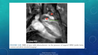 25 
Mehdi Soleymani Goloujeh 
Medical Nanotechnology Department 
 