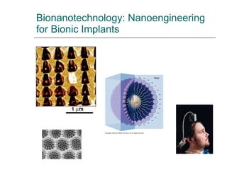 Bionanotechnology: Nanoengineering for Bionic Implants 
