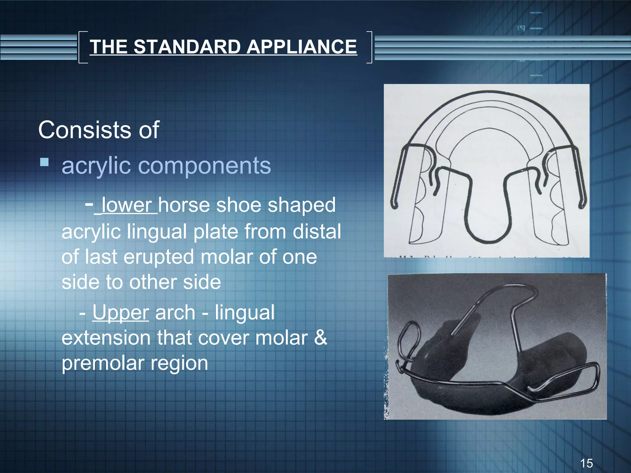 THE STANDARD APPLIANCE



Consists of
 acrylic components
    - lower horse shoe shaped
  acrylic lingual plate from distal
  of last erupted molar of one
  side to other side
    - Upper arch - lingual
  extension that cover molar &
  premolar region



                                      15
 