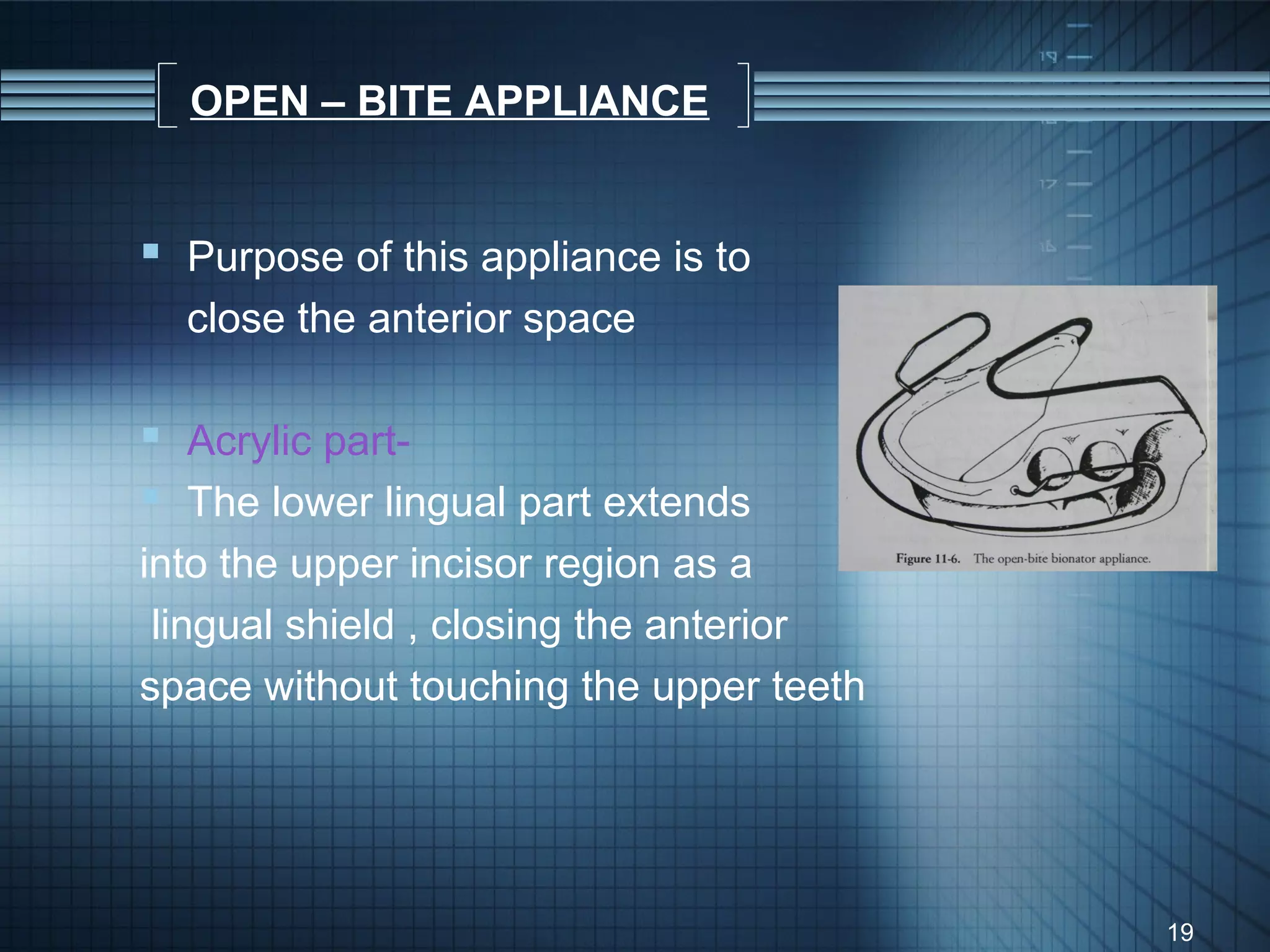 OPEN – BITE APPLIANCE


 Purpose of this appliance is to
  close the anterior space

 Acrylic part-
 The lower lingual part extends
into the upper incisor region as a
 lingual shield , closing the anterior
space without touching the upper teeth




                                         19
 