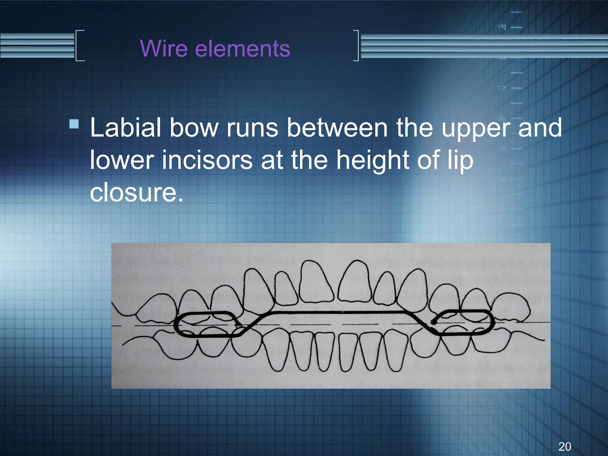 Wire elements


 Labial bow runs between the upper and
 lower incisors at the height of lip
 closure.




                                       20
 