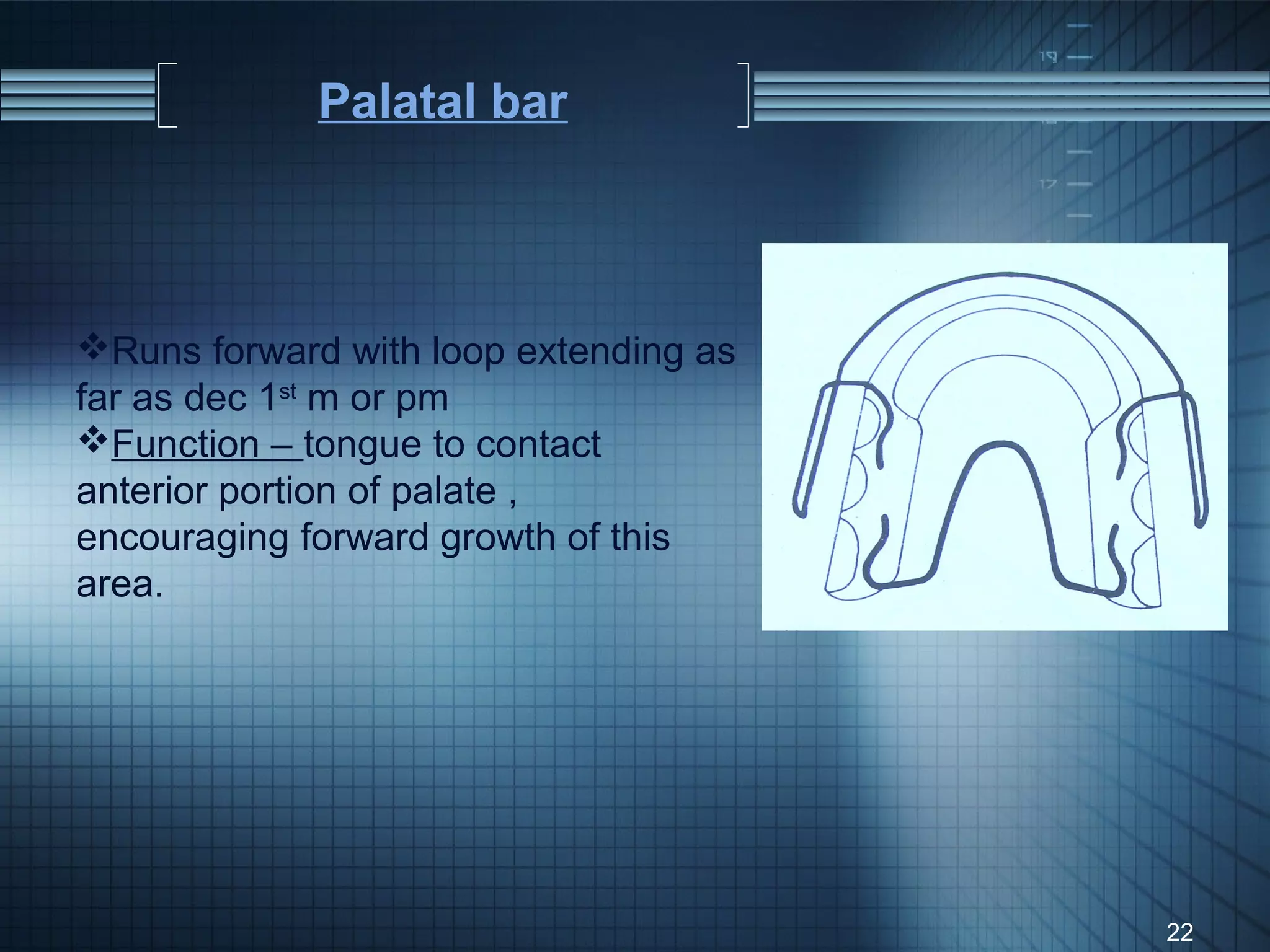 Palatal bar



Runs forward with loop extending as
far as dec 1st m or pm
Function – tongue to contact
anterior portion of palate ,
encouraging forward growth of this
area.




                                       22
 