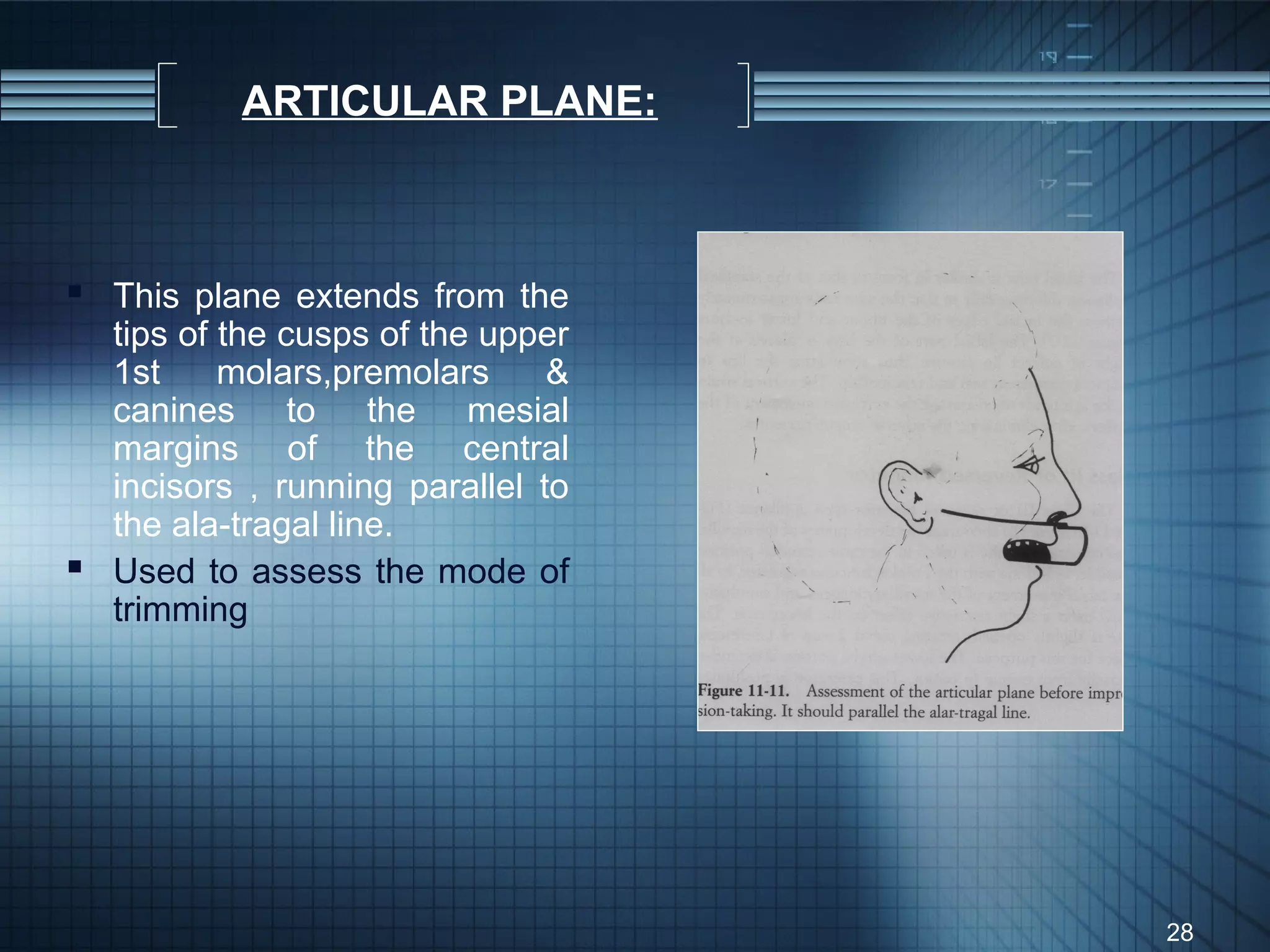 ARTICULAR PLANE:



 This plane extends from the
  tips of the cusps of the upper
  1st     molars,premolars     &
  canines to the mesial
  margins of the central
  incisors , running parallel to
  the ala-tragal line.
 Used to assess the mode of
  trimming




                                   28
 