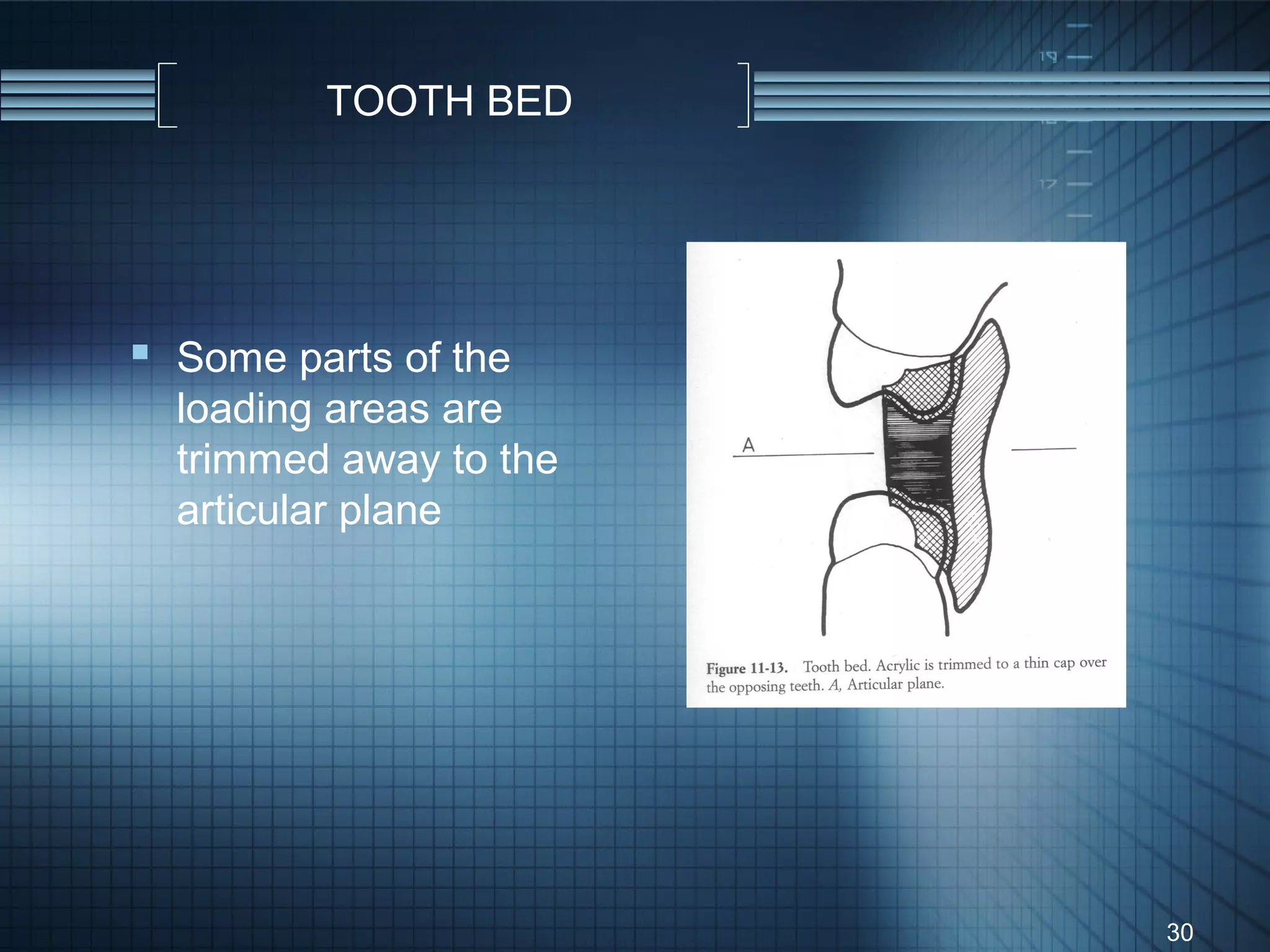 TOOTH BED




 Some parts of the
  loading areas are
  trimmed away to the
  articular plane




                        30
 