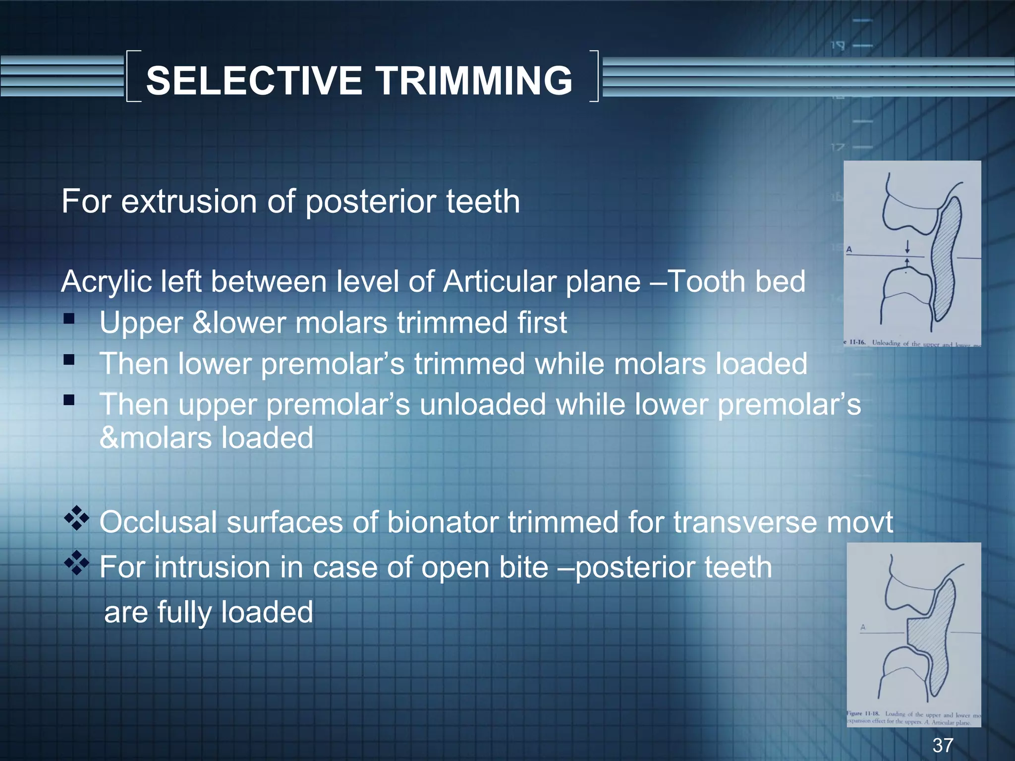 SELECTIVE TRIMMING

For extrusion of posterior teeth

Acrylic left between level of Articular plane –Tooth bed
 Upper &lower molars trimmed first
 Then lower premolar’s trimmed while molars loaded
 Then upper premolar’s unloaded while lower premolar’s
  &molars loaded

 Occlusal surfaces of bionator trimmed for transverse movt
 For intrusion in case of open bite –posterior teeth
   are fully loaded



                                                              37
 