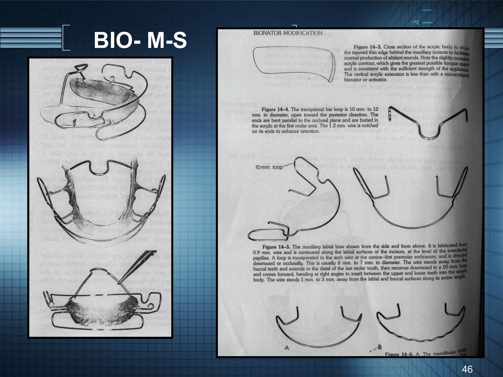 BIO- M-S




           46
 
