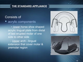 THE STANDARD APPLIANCE



Consists of
 acrylic components
    - lower horse shoe shaped
  acrylic lingual plate from distal
  of last erupted molar of one
  side to other side
    - Upper arch - lingual
  extension that cover molar &
  premolar region



                                      15
 