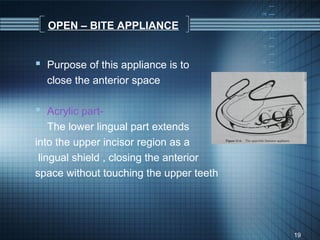 OPEN – BITE APPLIANCE


 Purpose of this appliance is to
  close the anterior space

 Acrylic part-
 The lower lingual part extends
into the upper incisor region as a
 lingual shield , closing the anterior
space without touching the upper teeth




                                         19
 