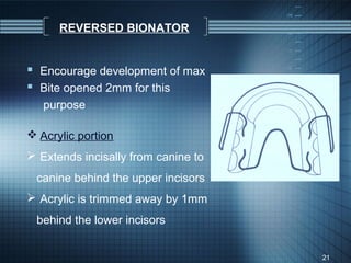 REVERSED BIONATOR


 Encourage development of max
 Bite opened 2mm for this
   purpose

 Acrylic portion
 Extends incisally from canine to
 canine behind the upper incisors
 Acrylic is trimmed away by 1mm
 behind the lower incisors


                                     21
 