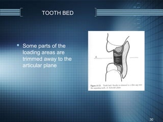 TOOTH BED




 Some parts of the
  loading areas are
  trimmed away to the
  articular plane




                        30
 