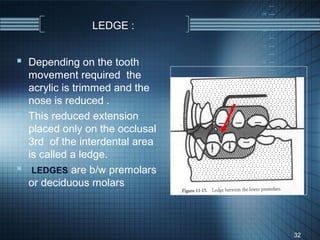 LEDGE :


 Depending on the tooth
  movement required the
  acrylic is trimmed and the
  nose is reduced .
 This reduced extension
  placed only on the occlusal
  3rd of the interdental area
  is called a ledge.
 LEDGES are b/w premolars
  or deciduous molars



                                32
 