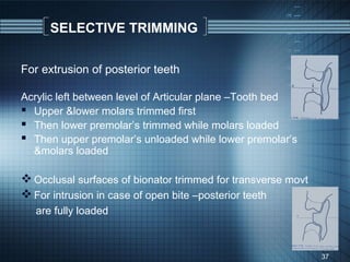 SELECTIVE TRIMMING

For extrusion of posterior teeth

Acrylic left between level of Articular plane –Tooth bed
 Upper &lower molars trimmed first
 Then lower premolar’s trimmed while molars loaded
 Then upper premolar’s unloaded while lower premolar’s
  &molars loaded

 Occlusal surfaces of bionator trimmed for transverse movt
 For intrusion in case of open bite –posterior teeth
   are fully loaded



                                                              37
 
