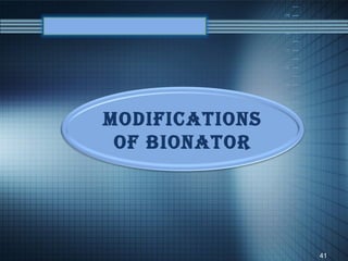 Modifications
 of Bionator




                41
 