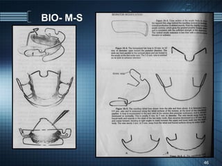 BIO- M-S




           46
 