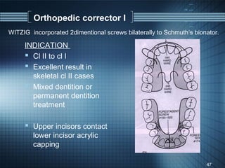 Orthopedic corrector I
WITZIG incorporated 2dimentional screws bilaterally to Schmuth’s bionator.

     INDICATION
      Cl II to cl I
      Excellent result in
       skeletal cl II cases
      Mixed dentition or
       permanent dentition
       treatment

      Upper incisors contact
        lower incisor acrylic
        capping

                                                                     47
 