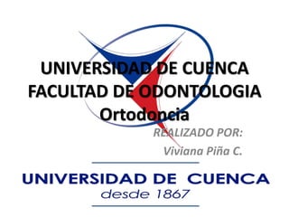UNIVERSIDAD DE CUENCA
FACULTAD DE ODONTOLOGIA
Ortodoncia
REALIZADO POR:
Viviana Piña C.
 