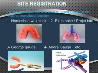 Various techniques are now used to record the bite to the
favoured mandibular position:
1- Horseshoe waxblock. 2- Exactobite / Projet bite .
3- George gauge. 4- Andra Gauge…etc.
48
 