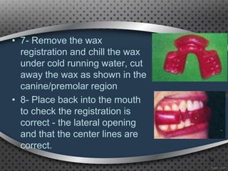 • 7- Remove the wax
registration and chill the wax
under cold running water, cut
away the wax as shown in the
canine/premolar region
• 8- Place back into the mouth
to check the registration is
correct - the lateral opening
and that the center lines are
correct.
52
 