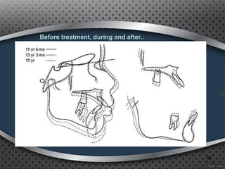 95
Before treatment, during and after..
 