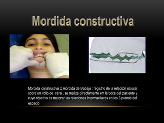 Mordida constructiva o mordida de trabajo : registro de la relación oclusal
sobre un rollo de cera , se realiza directamente en la boca del paciente y
cuyo objetivo es mejorar las relaciones intermaxilares en los 3 planos del
espacio
 