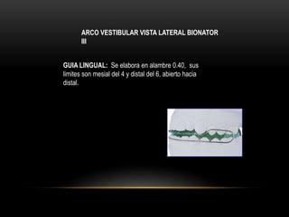 ARCO VESTIBULAR VISTA LATERAL BIONATOR
III
GUIA LINGUAL: Se elabora en alambre 0.40, sus
limites son mesial del 4 y distal del 6, abierto hacia
distal.
 