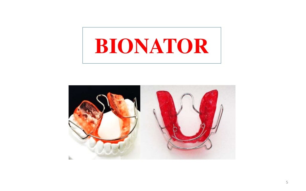Bionator and frankel appliances in orthodontics