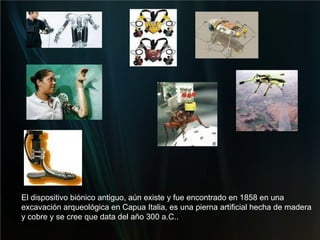El dispositivo biónico antiguo, aún existe y fue encontrado en 1858 en una excavación arqueológica en Capua Italia, es una pierna artificial hecha de madera y cobre y se cree que data del año 300 a.C..  
