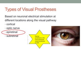 Bionic eye | PDF