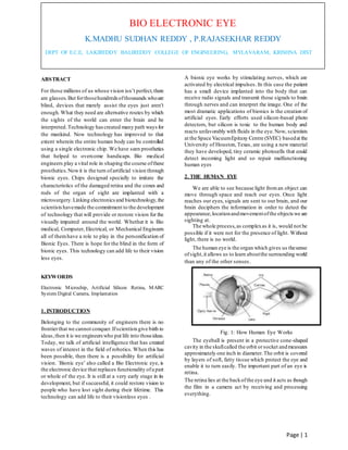 Bionic eye | DOCX