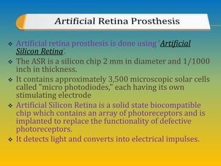  Artificial retina prosthesis is done using ‘Artificial
Silicon Retina’.
 The ASR is a silicon chip 2 mm in diameter and 1/1000
inch in thickness.
 It contains approximately 3,500 microscopic solar cells
called "micro photodiodes," each having its own
stimulating electrode
 Artificial Silicon Retina is a solid state biocompatible
chip which contains an array of photoreceptors and is
implanted to replace the functionality of defective
photoreceptors.
 It detects light and converts into electrical impulses.
 