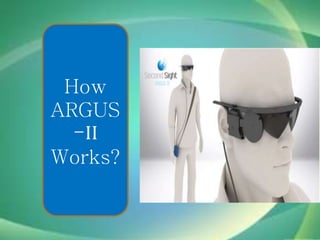 How
ARGUS
-II
Works?
 