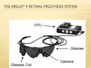 THE ARGUS® II RETINAL PROSTHESIS SYSTEM
 