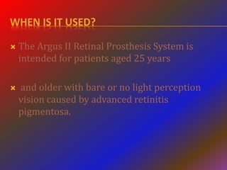 WHEN IS IT USED?
 The Argus II Retinal Prosthesis System is
intended for patients aged 25 years
 and older with bare or no light perception
vision caused by advanced retinitis
pigmentosa.
 