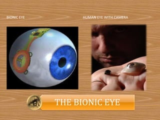 THE BIONIC EYE
BIONIC EYE HUMAN EYE WITH CAMERA
 