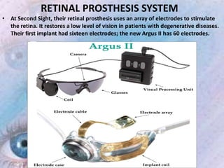 Bionic eye | PDF