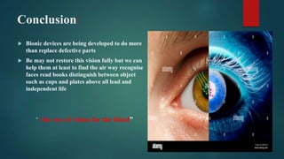 Conclusion:
 Bionic devices are being developed to do more
than replace defective parts
 Be may not restore this vision fully but we can
help them at least to find the air way recognise
faces read books distinguish between object
such as cups and plates above all lead and
independent life
“ the ray of vision for the blind”
 