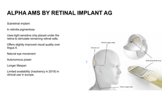 Bionic Eye Technology: Innovations in Restoring Vision and Fighting ...