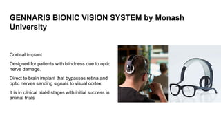 Bionic Eye Technology: Innovations in Restoring Vision and Fighting ...