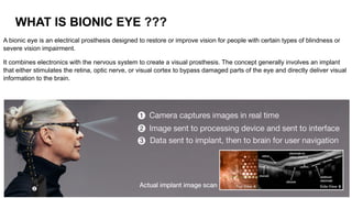 Bionic Eye Technology: Innovations in Restoring Vision and Fighting ...