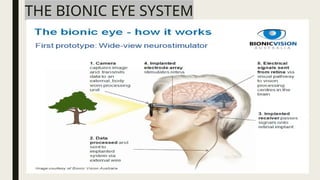 BIONIC EYE FINAL.pptx hhhhhhhhhhhhhhhhhhhh | PPTX