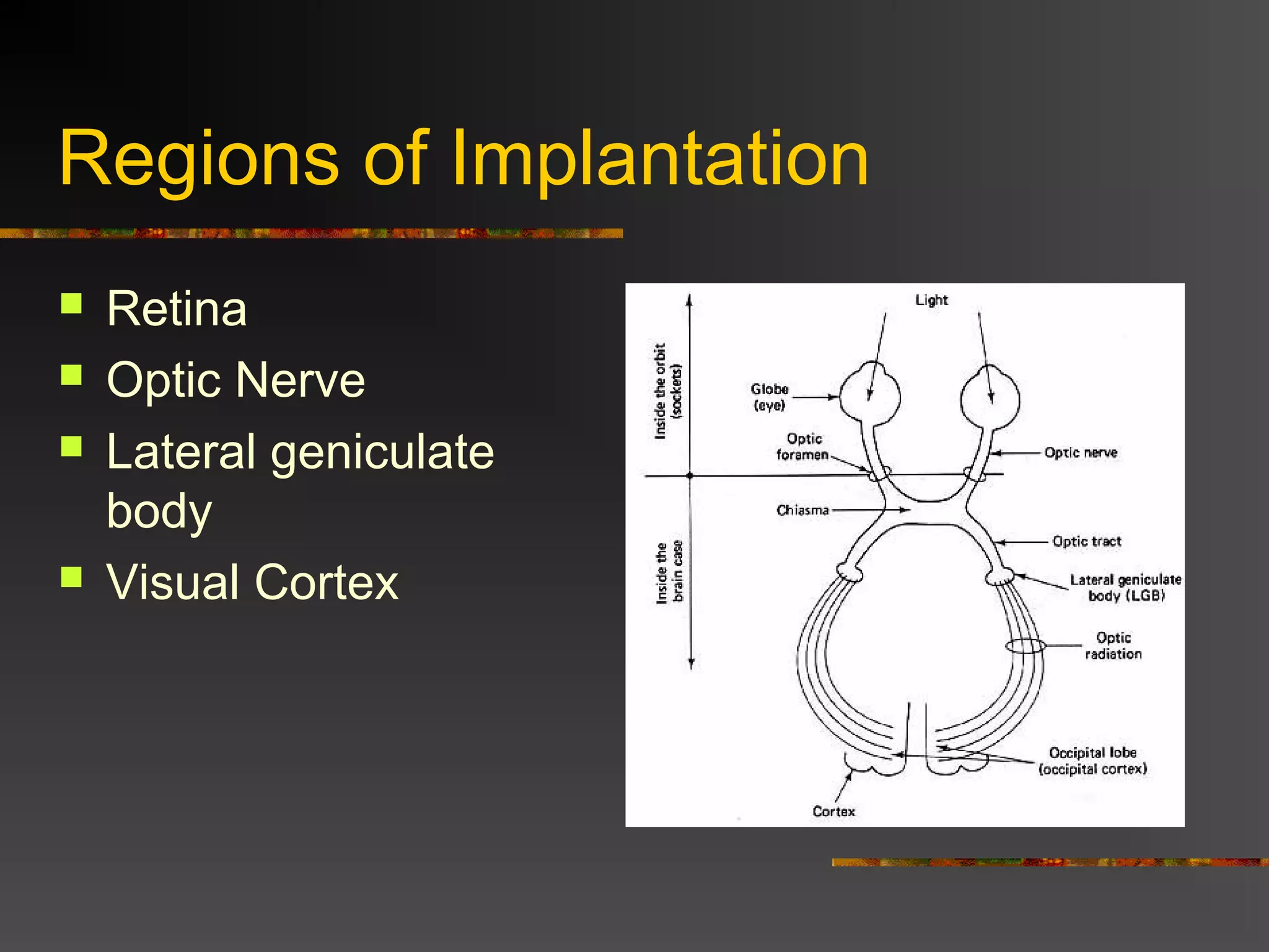 Regions of Implantation
 Retina
 Optic Nerve
 Lateral geniculate
body
 Visual Cortex
 