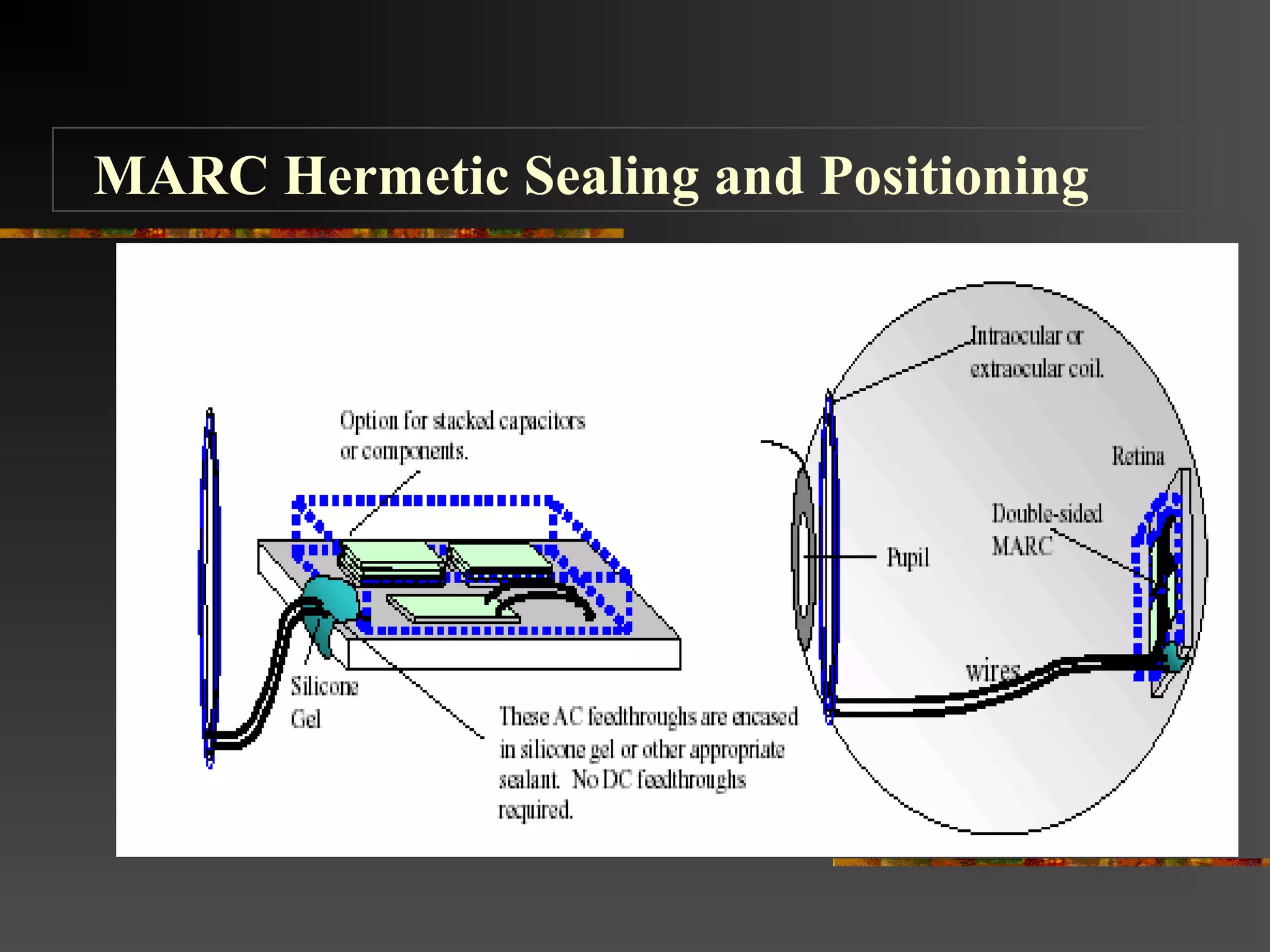 MARC Hermetic Sealing and Positioning
 