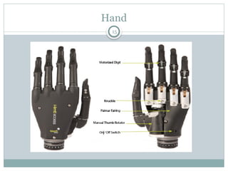 Bionic hand discussed in brief for ortho.pptx