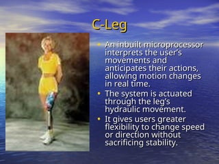 C-Leg
C-Leg
• An inbuilt microprocessor
An inbuilt microprocessor
interprets the user’s
interprets the user’s
movements and
movements and
anticipates their actions,
anticipates their actions,
allowing motion changes
allowing motion changes
in real time.
in real time.
• The system is actuated
The system is actuated
through the leg’s
through the leg’s
hydraulic movement.
hydraulic movement.
• It gives users greater
It gives users greater
flexibility to change speed
flexibility to change speed
or direction without
or direction without
sacrificing stability.
sacrificing stability.
 